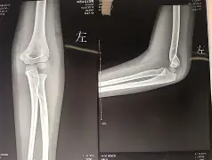 浜烘皯甯佹眹鐜囦腑闂翠环鍏憡